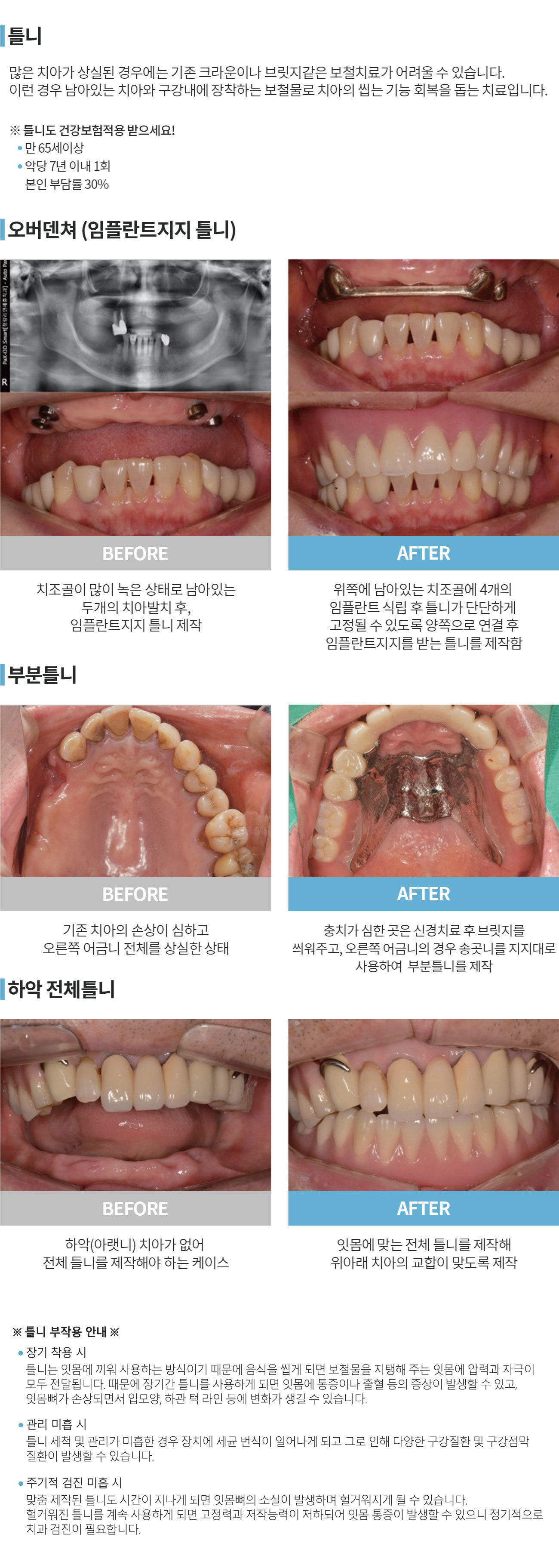 이미지명