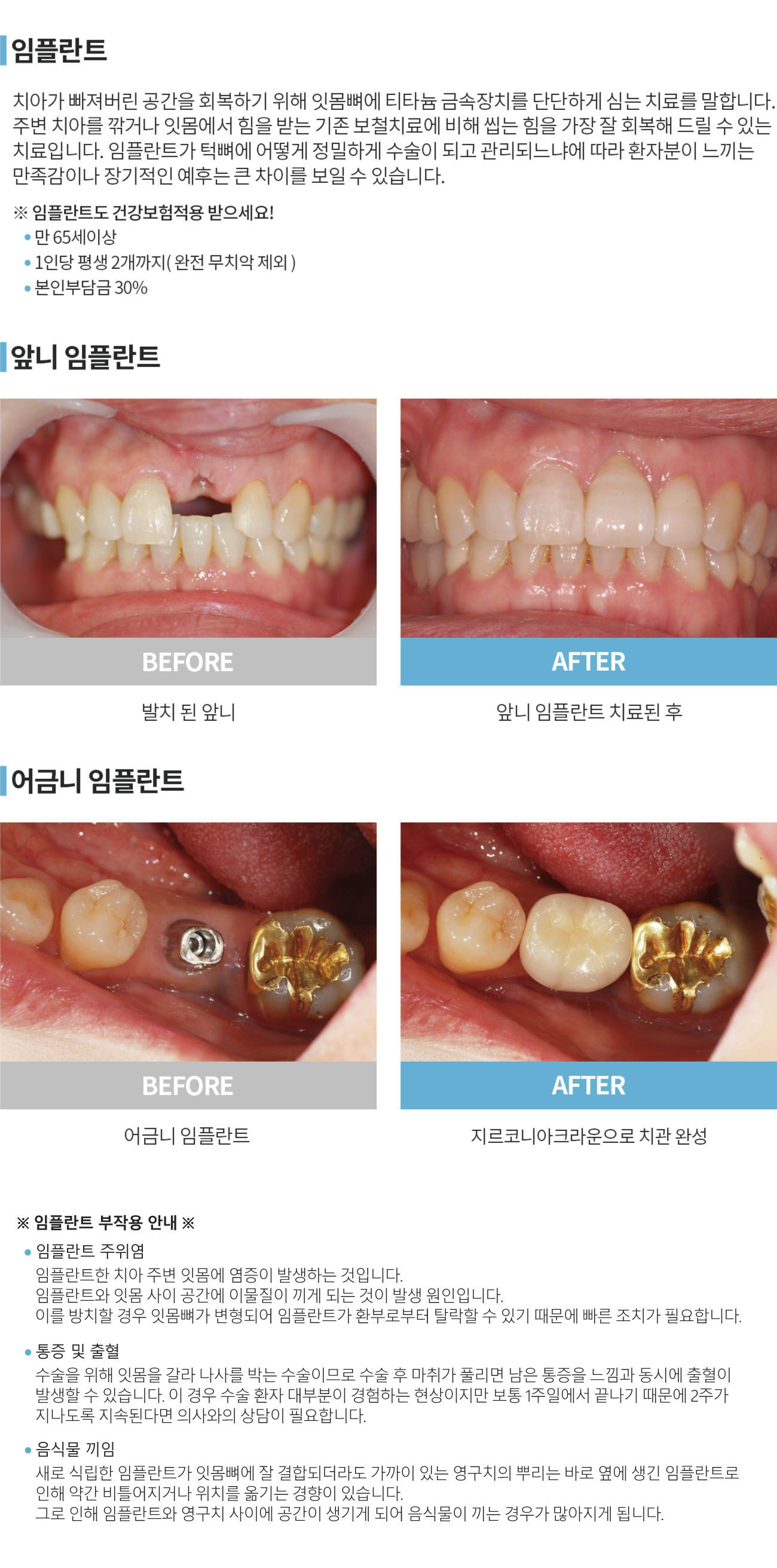 이미지명