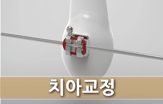 치아교정