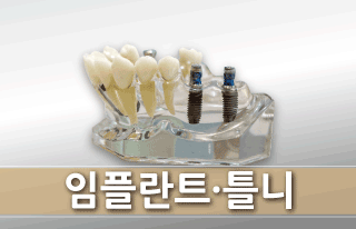 보철치료