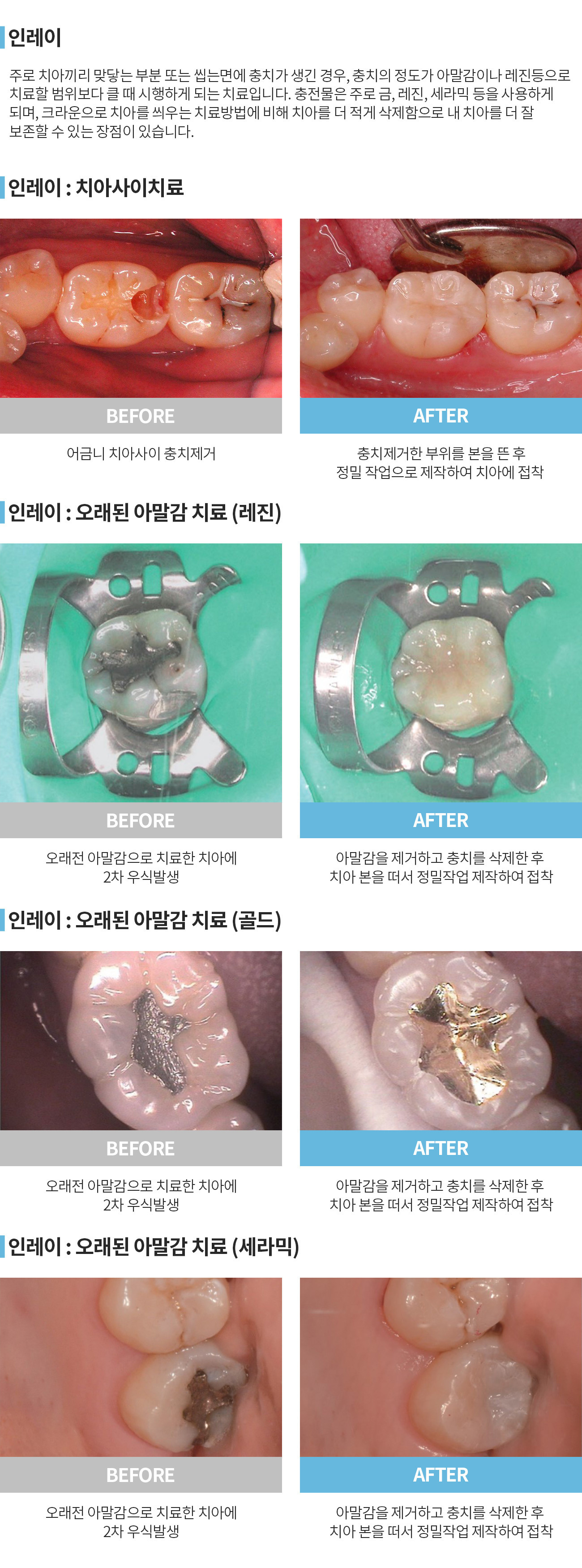 이미지명