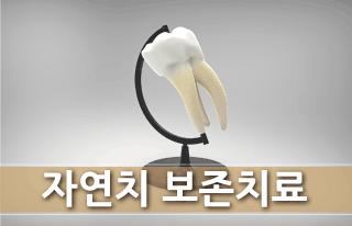자연치보존