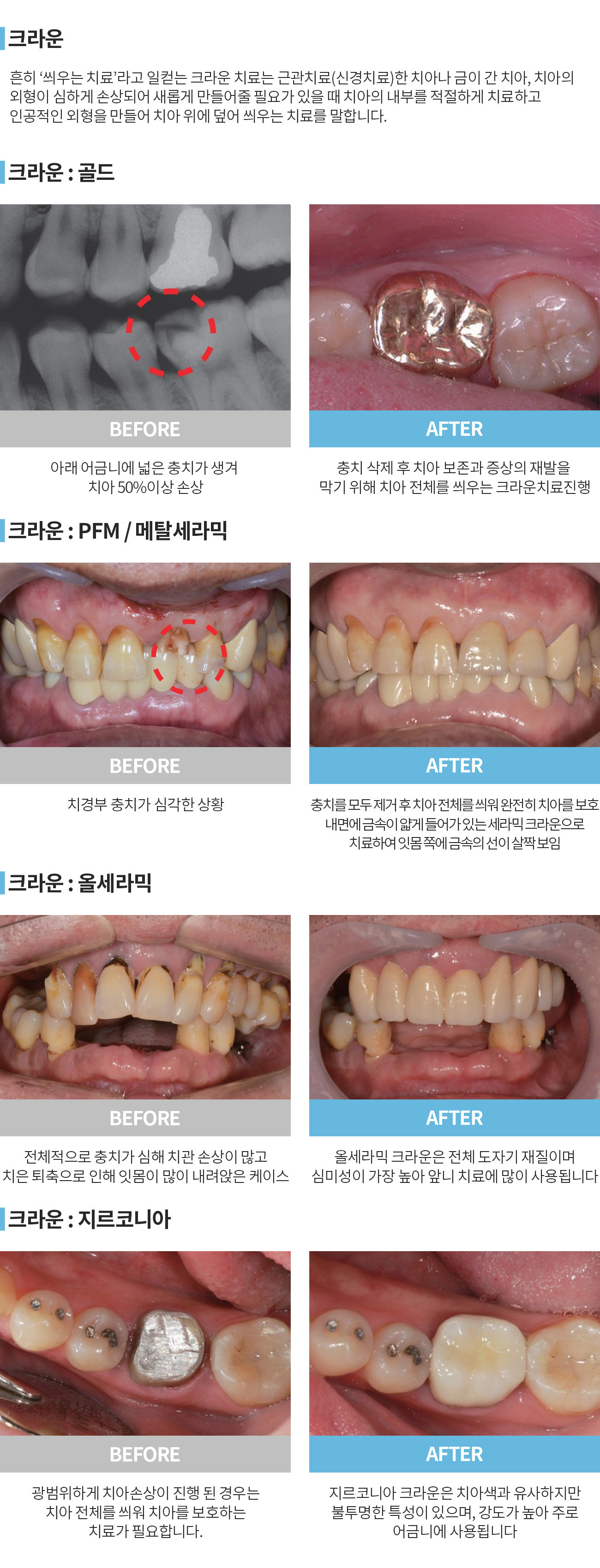 이미지명