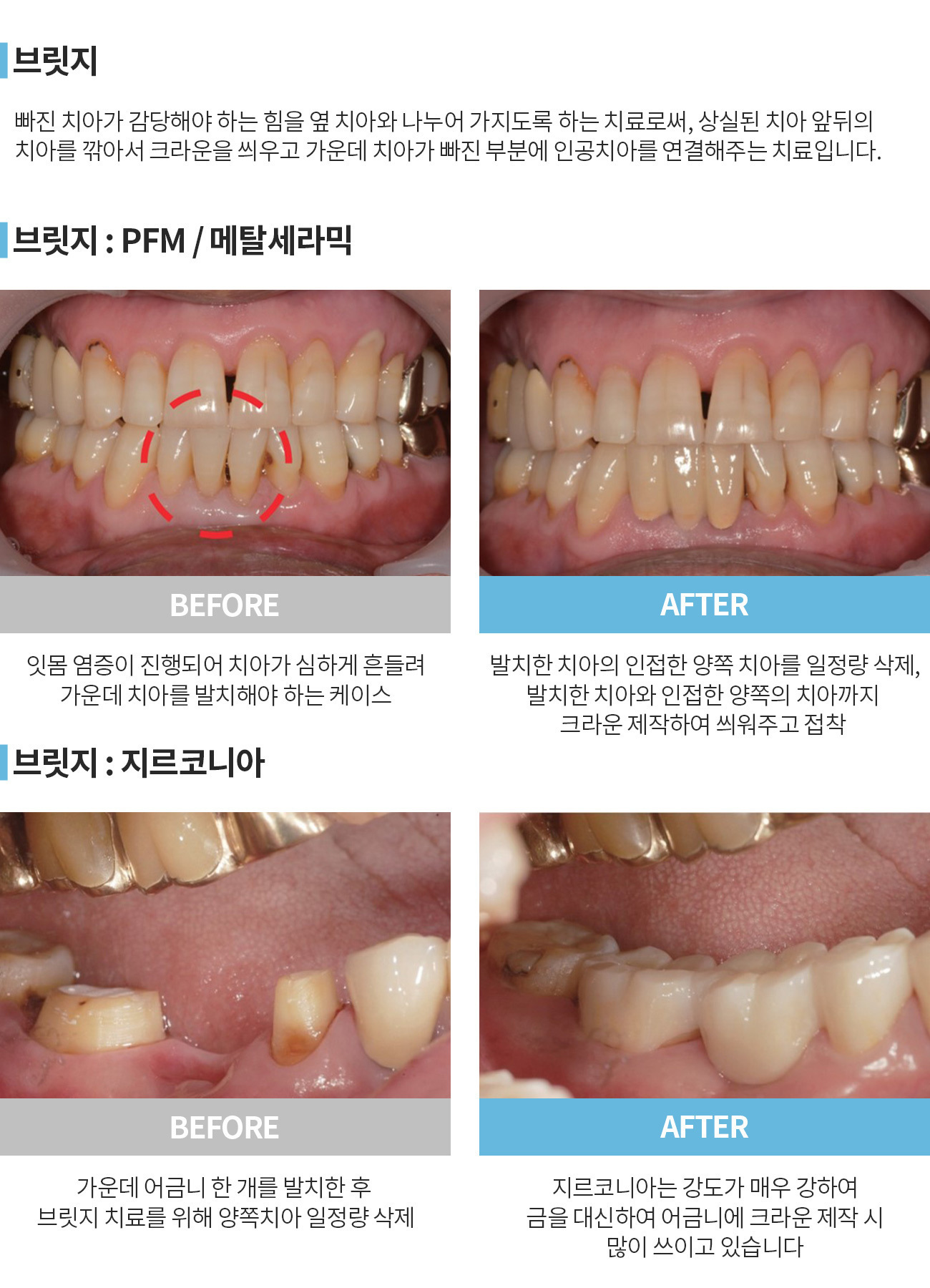 이미지명