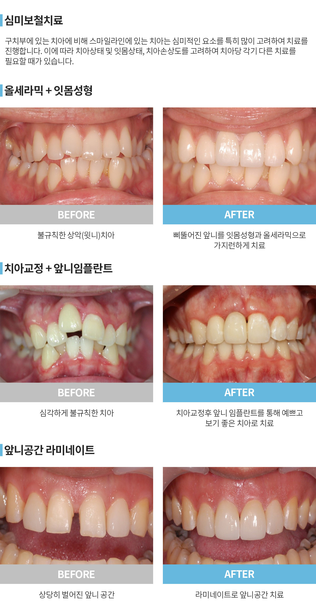 이미지명
