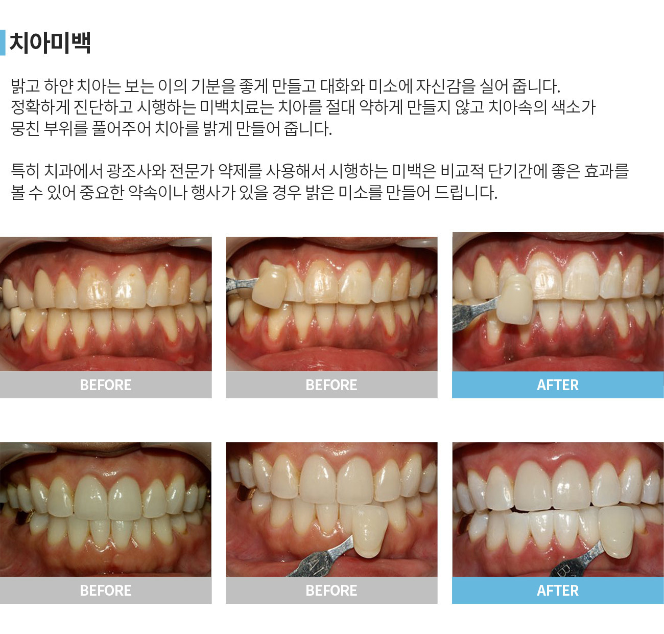 이미지명